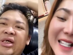 Gigi Saya Tetap Bersih, Berbeda dengan Kamu